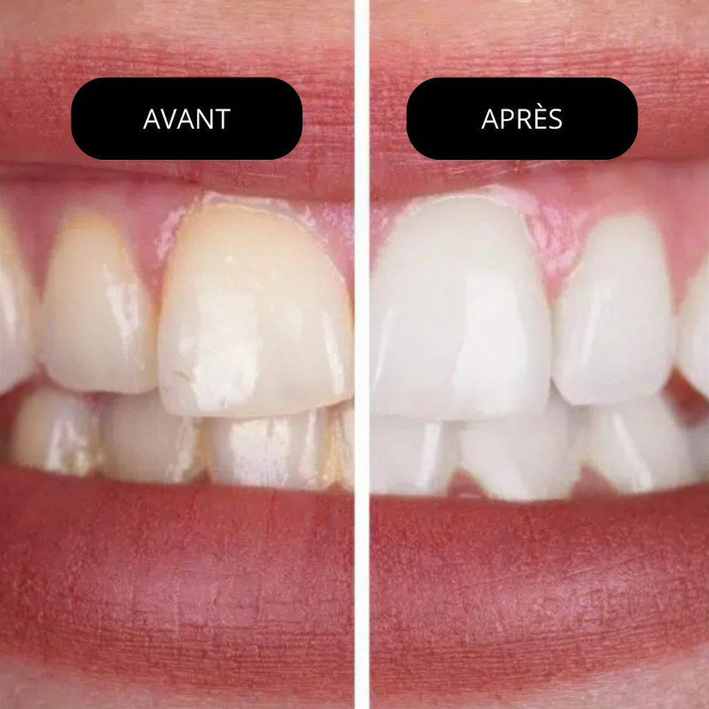 HydraSmile™️— La révolution de votre hygiène dentaire